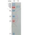 sp-pme101223 siglec5 sp1