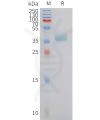 sp-pme101427 cxcr6 sp1