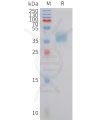 sp-pme101428 crth2 sp1