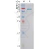 sp-pme101429 fstl3 sp1