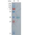 sp-pme101439 apoe sp1