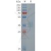 sp-pme101449 pomc sp1