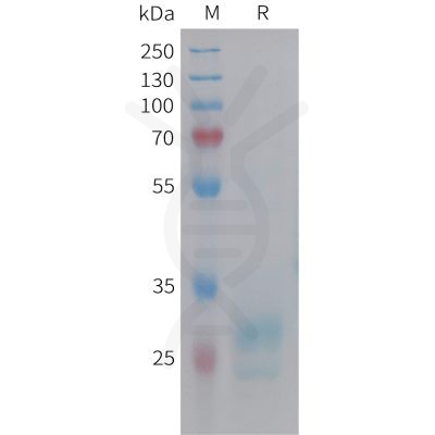 sp-pme101453 hmgb1 sp1