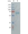 sp-pme101459 clec10a sp1