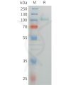 sp-pme101472 tpo sp1