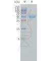 sp-pme101501 ca12 sp1