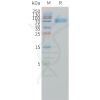 sp-pme101502 il1ra sp1