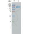 sp-pme101502 il1ra sp1
