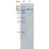 sp-pme101507 il1r2 sp1