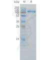 sp-pme101507 il1r2 sp1
