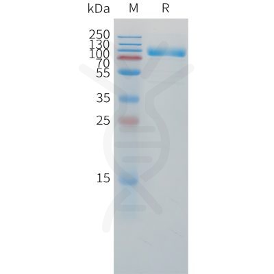 sp-pme101507 il1r2 sp1