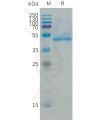 sp-pme101509 b4galt1 sp1