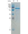 sp-pme101511 cd73 sp1