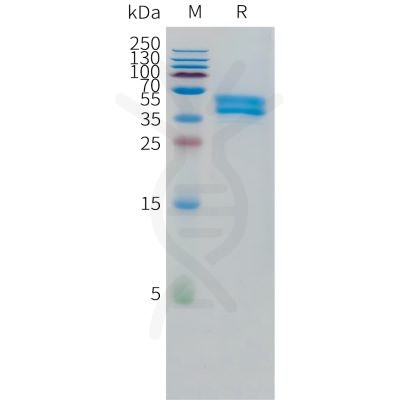 sp-pme101513 or1a1 sp1