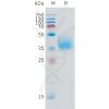 sp-pme101516 ifngr1 sp1 1