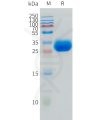 sp-pme101517 lamp5 sp1 1