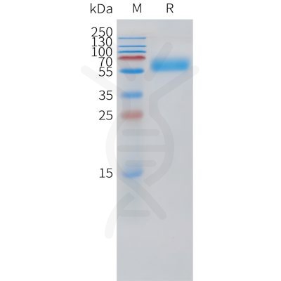 sp-pme101520 pth1r sp1 1