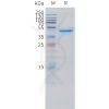 sp-pme101521 vegfd sp1 1