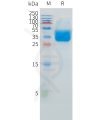 sp-pme101527 ifnar2 sp1