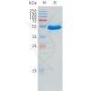 sp-pme101534 znrf3 sp1