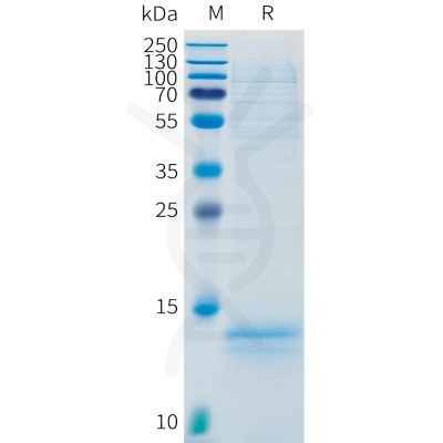 sp-pme101535 cd3e sp1