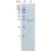 sp-pme101537 tnfsf15 sp1