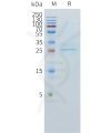 sp-pme101540 clec1a sp1