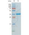 sp-pme101549 apoe2 sp1