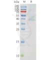sp-pme101555 pvrig sp1