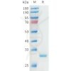 sp-pme101559 apoa1 sp1