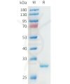 sp-pme101559 apoa1 sp1