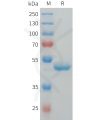 sp-pme101561 g csf sp1