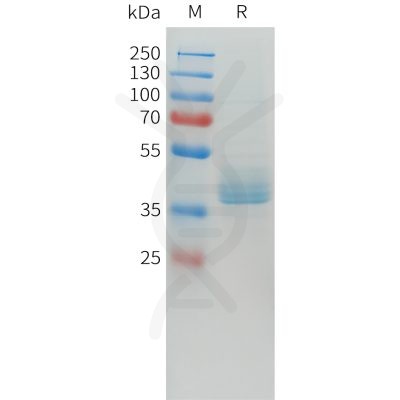 sp-pme101562 cdh17 sp1