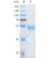 sp-pme101582 ror1 sp1