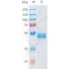 sp-pme101594 ror2 sp1