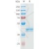 sp-pme101595 ror2 sp1