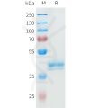 sp-pme101595 ror2 sp1