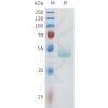 sp-pme101607 cdh1 sp1