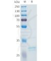 sp-pme101612 fgf2 sp1