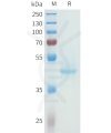 sp-pme101614 cdh3 sp1