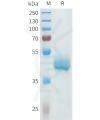 sp-pme101616 cdh3 sp1