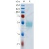 sp-pme101620 cd117 sp1