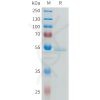 sp-pme101636 ror2 sp1