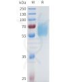 sp-pme101680 egfr sp1