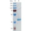 sp-pme101687 enpp3 sp1