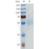 sp-pme101688 enpp3 sp1