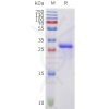 sp-pme101707 acvr2a sp1