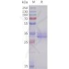 sp-pme101710 acvr2b sp1