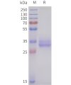 sp-pme101710 acvr2b sp1