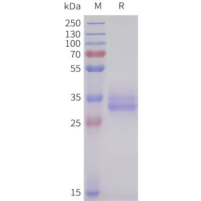 sp-pme101710 acvr2b sp1